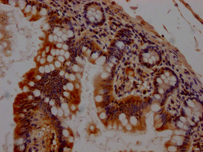 IHC image of CHEK1 Recombinant Monoclonal Antibody diluted at 1:100 and staining in paraffin-embedded human small intestine tissue performed on a Leica BondTM system. After dewaxing and hydration, antigen retrieval was mediated by high pressure in a citrate buffer (pH 6.0). Section was blocked with 10% normal goat serum 30min at RT. Then primary antibody (1% BSA) was incubated at 4℃ overnight. The primary is detected by a Goat anti-rabbit IgG polymer labeled by HRP and visualized using 0.05% DAB.