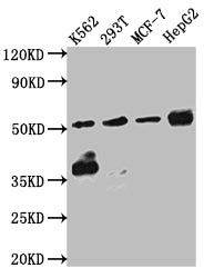 Western Blot | Positive WB detected in: K562 whole cell lysate, 293T whole cell lysate, MCF-7 whole cell lysate, HepG2 whole cell lysate | All lanes: Chk1 antibody at 1:1000 | Secondary | Goat polyclonal to rabbit IgG at 1/50000 dilution | Predicted band size: 55, 44, 51 kDa | Observed band size: 55 kDa