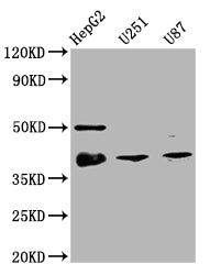 Western Blot | Positive WB detected in: HepG2 whole cell lysate, U251 whole cell lysate, U87 whole cell lysate | All lanes: TTF1 antibody at 1:2000 | Secondary | Goat polyclonal to rabbit IgG at 1/50000 dilution | Predicted band size: 39 kDa | Observed band size: 39 kDaNKX2-1 Recombinant Monoclonal Antibody