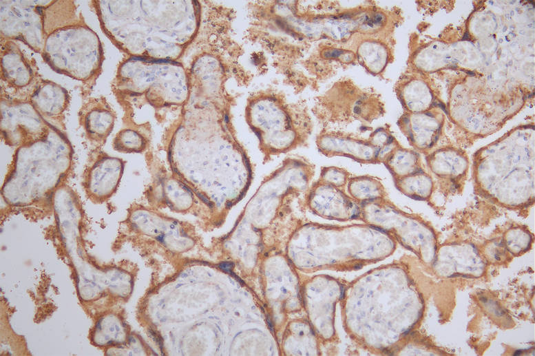 IHC image of ALPP Recombinant Monoclonal Antibody diluted at 1:50 and staining in paraffin-embedded human placenta tissue performed on a Leica BondTM system. After dewaxing and hydration, antigen retrieval was mediated by high pressure in a citrate buffer (pH 6.0). Section was blocked with 10% normal goat serum 30min at RT. Then primary antibody (1% BSA) was incubated at 4°C overnight. The primary is detected by a Goat anti-rabbit polymer IgG labeled by HRP and visualized using 0.39% DAB.ALPP Recombinant Monoclonal Antibody