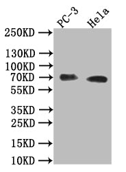 Western Blot | Positive WB detected in: PC-3 whole cell lysate,Hela whole cell lysate | All lanes: Placental alkaline phosphatase (PLAP) antibody at 1:1000 | Secondary | Goat polyclonal to rabbit IgG at 1/50000 dilution | Predicted band size: 70 kDa | Observed band size: 70 kDaALPP Recombinant Monoclonal Antibody