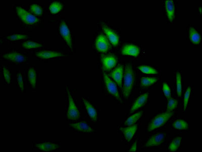 Immunofluorescence staining of Hela Cells with MAPK1 Recombinant Monoclonal Antibody at 1:50, counter-stained with DAPI. The cells were fixed in 4% formaldehyde, permeated by 0.2% TritonX-100, and blocked in 10% normal Goat Serum. The cells were then incubated with the antibody overnight at 4℃. Nuclear DNA was labeled in blue with DAPI. The secondary antibody was FITC-conjugated AffiniPure Goat Anti-Rabbit IgG (H+L).MAPK1 Recombinant Monoclonal Antibody