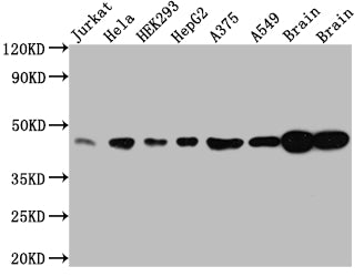 Western Blot | Positive WB detected in: Jurkat whole cell lysate, Hela whole cell lysate, HEK293 whole cell lysate, HepG2 whole cell lysate, A375 whole cell lysate, A549 whole cell lysate, Rat Brain whole cell lysate, Mouse Brain whole cell lysate | All lanes: ERK2 antibody at 1:1000 | Secondary | Goat polyclonal to rabbit IgG at 1/50000 dilution | Predicted band size: 42, 37 kDa | Observed band size: 42 kDaMAPK1 Recombinant Monoclonal Antibody