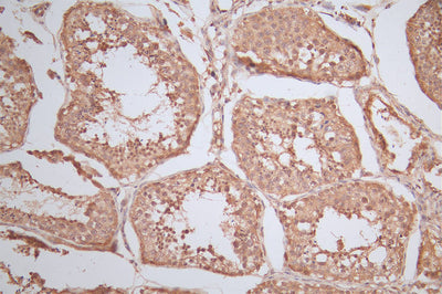 IHC image of the antibody diluted at 1:100 and staining in paraffin-embedded human testis tissue performed on a Leica BondTM system. After dewaxing and hydration, antigen retrieval was mediated by high pressure in a citrate buffer (pH 6.0). Section was blocked with 10% normal goat serum 30min at RT. Then primary antibody (1% BSA) was incubated at 4°C overnight. The primary is detected by a Goat anti-rabbit polymer IgG labeled by HRP and visualized using 0.78% DAB.RAN Recombinant Monoclonal Antibody