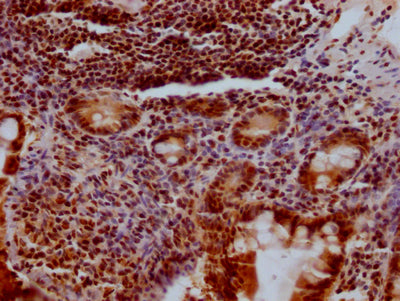 IHC image of KLF4 Recombinant Monoclonal Antibody diluted at 1:100 and staining in paraffin-embedded human small intestine tissue performed on a Leica BondTM system. After dewaxing and hydration, antigen retrieval was mediated by high pressure in a citrate buffer (pH 6.0). Section was blocked with 10% normal goat serum 30min at RT. Then primary antibody (1% BSA) was incubated at 4℃ overnight. The primary is detected by a Goat anti-rabbit IgG polymer labeled by HRP and visualized using 0.05% DAB.KLF4 Recombinant Monoclonal Antibody