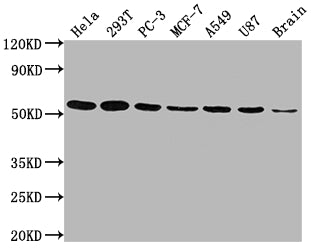 Western Blot | Positive WB detected in: Hela whole cell lysate, 293T whole cell lysate, PC-3 whole cell lysate, MCF-7 whole cell lysate, A549 whole cell lysate, U87 whole cell lysate, Brain tissue | All lanes: KLF4 antibody at 1:1500 | Secondary | Goat polyclonal to rabbit IgG at 1/50000 dilution | Predicted band size: 55, 52, 46, 13, 7 kDa | Observed band size: 55 kDaKLF4 Recombinant Monoclonal Antibody