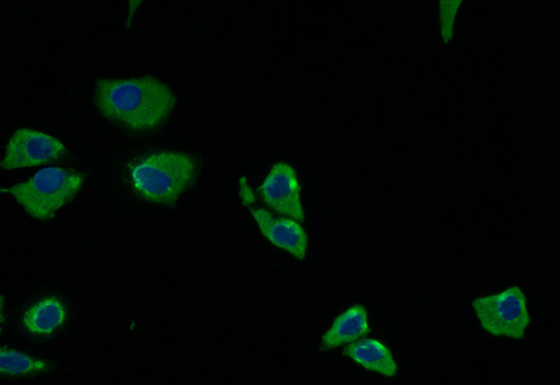 Immunofluorescence staining of Hela with PRKAR2A Recombinant Monoclonal Antibody at 1:5, counter-stained with DAPI. The cells were fixed in 4% formaldehyde and blocked in 10% normal Goat Serum. The cells were then incubated with the antibody overnight at 4°C. The secondary antibody was Alexa Fluor 512-congugated AffiniPure Goat Anti-Rabbit IgG(H+L).PRKAR2A Recombinant Monoclonal Antibody