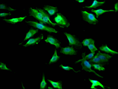 Immunofluorescence staining of Hela Cells with GSK3B Recombinant Monoclonal Antibody at 1:50, counter-stained with DAPI. The cells were fixed in 4% formaldehyde, permeated by 0.2% TritonX-100, and blocked in 10% normal Goat Serum. The cells were then incubated with the antibody overnight at 4℃. Nuclear DNA was labeled in blue with DAPI. The secondary antibody was FITC-conjugated AffiniPure Goat Anti-Rabbit IgG (H+L).GSK3B Recombinant Monoclonal Antibody