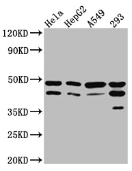 Western Blot | Positive WB detected in: Hela whole cell lysate, HepG2 whole cell lysate, A549 whole cell lysate, 293 whole cell lysate | All lanes: GSK3 beta Antibody at 1:1000 | Secondary | Goat polyclonal to rabbit IgG at 1/50000 dilution | Predicted band size: 47, 49 kDa | Observed band size: 47 kDaGSK3B Recombinant Monoclonal Antibody