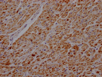 IHC image of ATP5B Recombinant Monoclonal Antibody diluted at 1:100 and staining in paraffin-embedded human heart tissue performed on a Leica BondTM system. After dewaxing and hydration, antigen retrieval was mediated by high pressure in a citrate buffer (pH 6.0). Section was blocked with 10% normal goat serum 30min at RT. Then primary antibody (1% BSA) was incubated at 4℃ overnight. The primary is detected by a Goat anti-rabbit IgG polymer labeled by HRP and visualized using 0.05% DAB.ATP5B Recombinant Monoclonal Antibody
