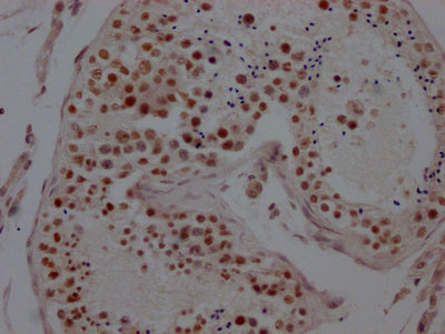 IHC image of KDM1A Recombinant Monoclonal Antibody diluted at 1:100 and staining in paraffin-embedded human testis tissue performed on a Leica BondTM system. After dewaxing and hydration, antigen retrieval was mediated by high pressure in a citrate buffer (pH 6.0). Section was blocked with 10% normal goat serum 30min at RT. Then primary antibody (1% BSA) was incubated at 4℃ overnight. The primary is detected by a Goat anti-rabbit IgG polymer labeled by HRP and visualized using 0.05% DAB.KDM1A Recombinant Monoclonal Antibody
