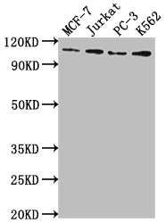 Western Blot | Positive WB detected in: MCF-7 whole cell lysate, Jurkat whole cell lysate, PC-3 whole cell lysate, K562 whole cell lysate | All lanes: KDM1A antibody at 1:2000 | Secondary | Goat polyclonal to rabbit IgG at 1/50000 dilution | Predicted band size: 93, 96 kDa | Observed band size: 110 kDaKDM1A Recombinant Monoclonal Antibody
