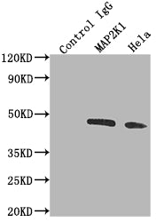 Immunoprecipitating MAP2K1 in Hela whole cell lysate | Lane 1: Rabbit control IgG instead of MAP2K1 Recombinant Monoclonal Antibody in Hela whole cell lysate. | For western blotting,a HRP-conjugated Protein G antibody was used as the secondary antibody (1/2000) | Lane 2: MAP2K1 Recombinant Monoclonal Antibody(2µg)+ Hela whole cell lysate(500µg) | Lane 3: Hela whole cell lysate (10µg)MAP2K1 Recombinant Monoclonal Antibody