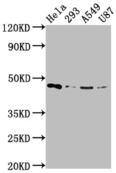 Western Blot | Positive WB detected in: Hela whole cell lysate, 293 whole cell lysate, A549 whole cell lysate, U87 whole cell lysate | All lanes: MAP2K1 antibody at 1:2000 | Secondary | Goat polyclonal to rabbit IgG at 1/50000 dilution | Predicted band size: 44, 41 kDa | Observed band size: 44 kDaMAP2K1 Recombinant Monoclonal Antibody