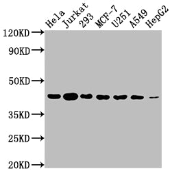 Western Blot | Positive WB detected in: Hela whole cell lysate, Jurkat whole cell lysate, 293 whole cell lysate, MCF-7 whole cell lysate, U251 whole cell lysate, A549 whole cell lysate, HepG2 whole cell lysate | All lanes: AURKB antibody at 1:2000 | Secondary | Goat polyclonal to rabbit IgG at 1/50000 dilution | Predicted band size: 40, 36, 17, 35 kDa | Observed band size: 40 kDaAURKB Recombinant Monoclonal Antibody