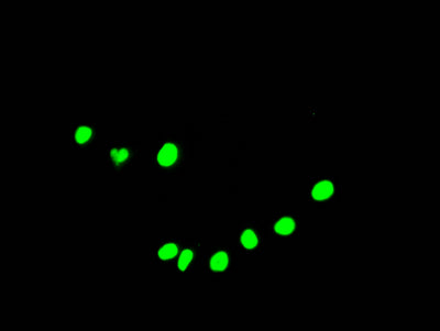 Immunofluorescence staining of HepG2 Cells with DDX5 Recombinant Monoclonal Antibody at 1:50, counter-stained with DAPI. The cells were fixed in 4% formaldehyde, permeated by 0.2% TritonX-100, and blocked in 10% normal Goat Serum. The cells were then incubated with the antibody overnight at 4℃. Nuclear DNA was labeled in blue with DAPI. The secondary antibody was FITC-conjugated AffiniPure Goat Anti-Rabbit IgG (H+L).