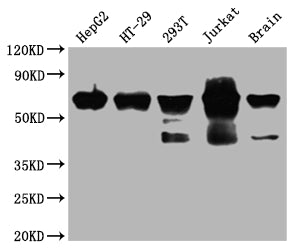 Western Blot | Positive WB detected in: HepG2 whole cell lysate, HT-29 whole cell lysate, 293T whole cell lysate, Jurkat whole cell lysate, Mouse brain tissue | All lanes: DDX5 antibody at 1:2000 | Secondary | Goat polyclonal to rabbit IgG at 1/50000 dilution | Predicted band size: 70, 61 kDa | Observed band size: 70 kDa