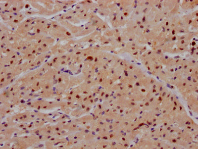 IHC image of MAPK14 Recombinant Monoclonal Antibody diluted at 1:100 and staining in paraffin-embedded human heart tissue performed on a Leica BondTM system. After dewaxing and hydration, antigen retrieval was mediated by high pressure in a citrate buffer (pH 6.0). Section was blocked with 10% normal goat serum 30min at RT. Then primary antibody (1% BSA) was incubated at 4℃ overnight. The primary is detected by a Goat anti-rabbit IgG polymer labeled by HRP and visualized using 0.05% DAB.MAPK14 Recombinant Monoclonal Antibody