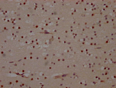 IHC image of MAPK14 Recombinant Monoclonal Antibody diluted at 1:100 and staining in paraffin-embedded human brain tissue performed on a Leica BondTM system. After dewaxing and hydration, antigen retrieval was mediated by high pressure in a citrate buffer (pH 6.0). Section was blocked with 10% normal goat serum 30min at RT. Then primary antibody (1% BSA) was incubated at 4℃ overnight. The primary is detected by a Goat anti-rabbit IgG polymer labeled by HRP and visualized using 0.05% DAB.MAPK14 Recombinant Monoclonal Antibody