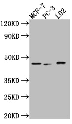Western Blot | Positive WB detected in: MCF-7 whole cell lysate, PC-3 whole cell lysate, L02 whole cell lysate | All lanes: p38 antibody at 1:1000 | Secondary | Goat polyclonal to rabbit IgG at 1/50000 dilution | Predicted band size: 42, 42, 35, 36 kDa | Observed band size: 42 kDaMAPK14 Recombinant Monoclonal Antibody