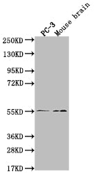 Western Blot | Positive WB detected in: PC-3 whole cell lysate, Mouse brain tissue | All lanes: MAPK10 antibody at 1:2000 | Secondary | Goat polyclonal to rabbit IgG at 1/50000 dilution | Predicted band size: 53, 49, 32kDa | Observed band size: 55 kDaMAPK10 Recombinant Monoclonal Antibody