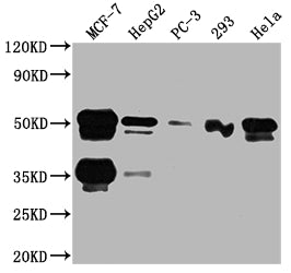 Western Blot | Positive WB detected in: MCF-7 whole cell lysate, HepG2 whole cell lysate, PC-3 whole cell lysate, 293 whole cell lysate, Hela whole cell lysate | All lanes: FOXA1 antibody at 1:2000 | Secondary | Goat polyclonal to rabbit IgG at 1/50000 dilution | Predicted band size: 50, 46 kDa | Observed band size: 50 kDaFOXA1 Recombinant Monoclonal Antibody