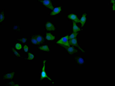 Immunofluorescence staining of HepG2 Cells with MAOA Recombinant Monoclonal Antibody at 1:50, counter-stained with DAPI. The cells were fixed in 4% formaldehyde, permeated by 0.2% TritonX-100, and blocked in 10% normal Goat Serum. The cells were then incubated with the antibody overnight at 4℃. Nuclear DNA was labeled in blue with DAPI. The secondary antibody was FITC-conjugated AffiniPure Goat Anti-Rabbit IgG (H+L).MAOA Recombinant Monoclonal Antibody
