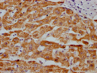 IHC image of the antibody diluted at 1:100 and staining in paraffin-embedded human liver tissue performed on a Leica BondTM system. After dewaxing and hydration, antigen retrieval was mediated by high pressure in a citrate buffer (pH 6.0). Section was blocked with 10% normal goat serum 30min at RT. Then primary antibody (1% BSA) was incubated at 4℃ overnight. The primary is detected by a Goat anti-rabbit IgG polymer labeled by HRP and visualized using 0.05% DAB.MAOA Recombinant Monoclonal Antibody