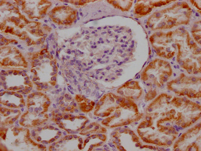IHC image of MAOA Recombinant Monoclonal Antibody diluted at 1:100 and staining in paraffin-embedded human kidney tissue performed on a Leica BondTM system. After dewaxing and hydration, antigen retrieval was mediated by high pressure in a citrate buffer (pH 6.0). Section was blocked with 10% normal goat serum 30min at RT. Then primary antibody (1% BSA) was incubated at 4℃ overnight. The primary is detected by a Goat anti-rabbit IgG polymer labeled by HRP and visualized using 0.05% DAB.MAOA Recombinant Monoclonal Antibody