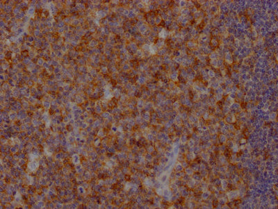 IHC image of FAS Recombinant Monoclonal Antibody diluted at 1:100 and staining in paraffin-embedded human tonsil tissue performed on a Leica BondTM system. After dewaxing and hydration, antigen retrieval was mediated by high pressure in a citrate buffer (pH 6.0). Section was blocked with 10% normal goat serum 30min at RT. Then primary antibody (1% BSA) was incubated at 4℃ overnight. The primary is detected by a Goat anti-rabbit IgG polymer labeled by HRP and visualized using 0.05% DAB.