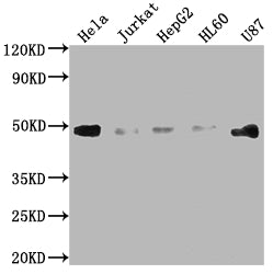 Western Blot | Positive WB detected in: Hela whole cell lysate, Jurkat whole cell lysate, HepG2 whole cell lysate, HL60 whole cell lysate, U87 whole cell lysate | All lanes: FAS antibody at 1:2000 | Secondary | Goat polyclonal to rabbit IgG at 1/50000 dilution | Predicted band size: 38, 12, 10, 17, 15, 36, 25 kDa | Observed band size: 45 kDa