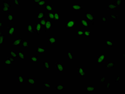 Immunofluorescence staining of Hela Cells with IKBKB Recombinant Monoclonal Antibody at 1:50, counter-stained with DAPI. The cells were fixed in 4% formaldehyde, permeated by 0.2% TritonX-100, and blocked in 10% normal Goat Serum. The cells were then incubated with the antibody overnight at 4℃. Nuclear DNA was labeled in blue with DAPI. The secondary antibody was FITC-conjugated AffiniPure Goat Anti-Rabbit IgG (H+L).IKBKB Recombinant Monoclonal Antibody