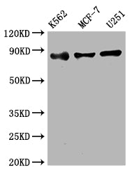 Western Blot | Positive WB detected in: K562 whole cell lysate, MCF-7 whole cell lysate, U251 whole cell lysate | All lanes: IKK beta antibody at 1:2000 | Secondary | Goat polyclonal to rabbit IgG at 1/50000 dilution | Predicted band size: 87 kDa | Observed band size: 87 kDaIKBKB Recombinant Monoclonal Antibody