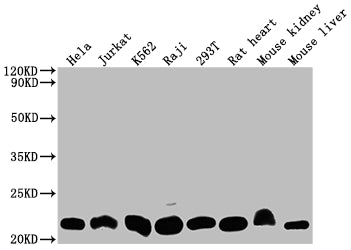 Western Blot | Positive WB detected in: Hela whole cell lysate, Jurkat whole cell lysate, K562 whole cell lysate, Raji whole cell lysate, 293T whole cell lysate, Rat heart tissue, Mouse kidney tissue, Mouse liver tissue | All lanes: DHFR antibody at 1:2000 | Secondary | Goat polyclonal to rabbit IgG at 1/50000 dilution | Predicted band size: 22, 16 kDa | Observed band size: 22 kDa