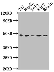 Western Blot | Positive WB detected in: 293 whole cell lysate, HepG2 whole cell lysate, Hela whole cell lysate, K562 whole cell lysate, Rat brain tissue | All lanes: FNTB antibody at 1:2000 | Secondary | Goat polyclonal to rabbit IgG at 1/50000 dilution | Predicted band size: 49, 44 kDa | Observed band size: 49 kDaFNTB Recombinant Monoclonal Antibody