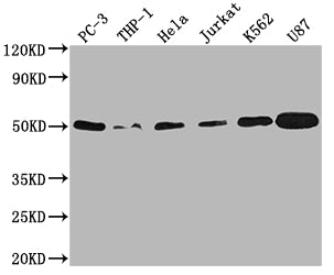 Western Blot | Positive WB detected in: PC-3 whole cell lysate, THP-1 whole cell lysate, Hela whole cell lysate, Jurkat whole cell lysate, K562 whole cell lysate, U87 whole cell lysate | All lanes: PTPN1 antibody at 1:2000 | Secondary | Goat polyclonal to rabbit IgG at 1/50000 dilution | Predicted band size: 50 kDa | Observed band size: 50 kDaPTPN1 Recombinant Monoclonal Antibody