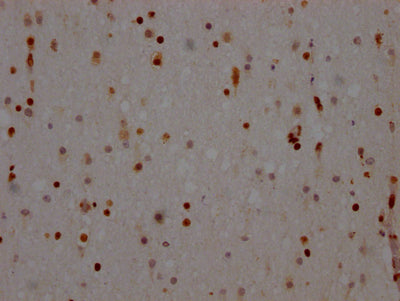 IHC image of NONO Recombinant Monoclonal Antibody diluted at 1:100 and staining in paraffin-embedded human brain tissue performed on a Leica BondTM system. After dewaxing and hydration, antigen retrieval was mediated by high pressure in a citrate buffer (pH 6.0). Section was blocked with 10% normal goat serum 30min at RT. Then primary antibody (1% BSA) was incubated at 4℃ overnight. The primary is detected by a Goat anti-rabbit IgG polymer labeled by HRP and visualized using 0.05% DAB.NONO Recombinant Monoclonal Antibody