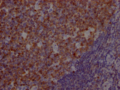 IHC image of POU2AF1 Recombinant Monoclonal Antibody diluted at 1:100 and staining in paraffin-embedded human tonsil tissue performed on a Leica BondTM system. After dewaxing and hydration, antigen retrieval was mediated by high pressure in a citrate buffer (pH 6.0). Section was blocked with 10% normal goat serum 30min at RT. Then primary antibody (1% BSA) was incubated at 4℃ overnight. The primary is detected by a Goat anti-rabbit IgG polymer labeled by HRP and visualized using 0.05% DAB.POU2AF1 Recombinant Monoclonal Antibody