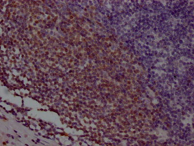 IHC image of POU2AF1 Recombinant Monoclonal Antibody diluted at 1:100 and staining in paraffin-embedded human appendix tissue performed on a Leica BondTM system. After dewaxing and hydration, antigen retrieval was mediated by high pressure in a citrate buffer (pH 6.0). Section was blocked with 10% normal goat serum 30min at RT. Then primary antibody (1% BSA) was incubated at 4℃ overnight. The primary is detected by a Goat anti-rabbit IgG polymer labeled by HRP and visualized using 0.05% DAB.POU2AF1 Recombinant Monoclonal Antibody