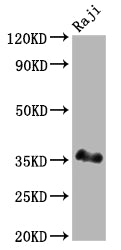 Western Blot | Positive WB detected in: Raji whole cell lysate | All lanes: BOB1 antibody at 1:2000 | Secondary | Goat polyclonal to rabbit IgG at 1/50000 dilution | Predicted band size: 28 kDa | Observed band size: 35 kDaPOU2AF1 Recombinant Monoclonal Antibody