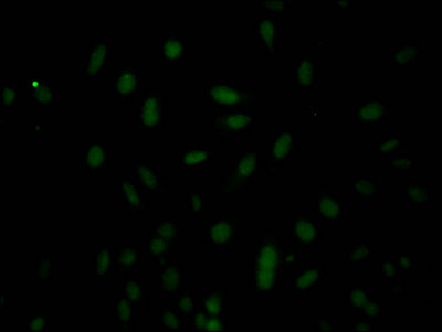 Immunofluorescence staining of Hela Cells with CASP3 Recombinant Monoclonal Antibody at 1:50, counter-stained with DAPI. The cells were fixed in 4% formaldehyde, permeated by 0.2% TritonX-100, and blocked in 10% normal Goat Serum. The cells were then incubated with the antibody overnight at 4℃. Nuclear DNA was labeled in blue with DAPI. The secondary antibody was FITC-conjugated AffiniPure Goat Anti-Rabbit IgG (H+L).