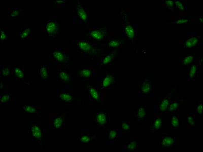 Immunofluorescence staining of Hela Cells with ILF3 Recombinant Monoclonal Antibody at 1:50, counter-stained with DAPI. The cells were fixed in 4% formaldehyde, permeated by 0.2% TritonX-100, and blocked in 10% normal Goat Serum. The cells were then incubated with the antibody overnight at 4℃. Nuclear DNA was labeled in blue with DAPI. The secondary antibody was FITC-conjugated AffiniPure Goat Anti-Rabbit IgG (H+L).ILF3 Recombinant Monoclonal Antibody