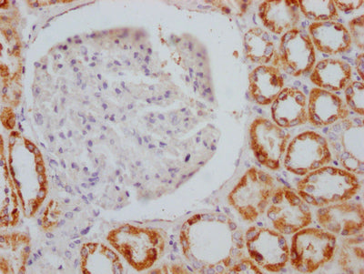 IHC image of AIFM1 Recombinant Monoclonal Antibody diluted at 1:100 and staining in paraffin-embedded human kidney tissue performed on a Leica BondTM system. After dewaxing and hydration, antigen retrieval was mediated by high pressure in a citrate buffer (pH 6.0). Section was blocked with 10% normal goat serum 30min at RT. Then primary antibody (1% BSA) was incubated at 4℃ overnight. The primary is detected by a Goat anti-rabbit IgG polymer labeled by HRP and visualized using 0.05% DAB.AIFM1 Recombinant Monoclonal Antibody
