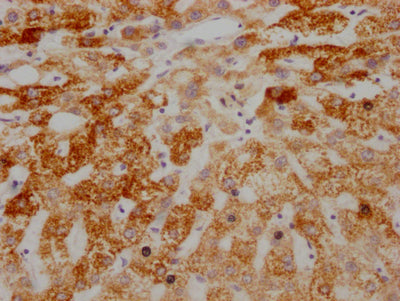 IHC image of AIFM1 Recombinant Monoclonal Antibody diluted at 1:100 and staining in paraffin-embedded human liver tissue performed on a Leica BondTM system. After dewaxing and hydration, antigen retrieval was mediated by high pressure in a citrate buffer (pH 6.0). Section was blocked with 10% normal goat serum 30min at RT. Then primary antibody (1% BSA) was incubated at 4℃ overnight. The primary is detected by a Goat anti-rabbit IgG polymer labeled by HRP and visualized using 0.05% DAB.AIFM1 Recombinant Monoclonal Antibody