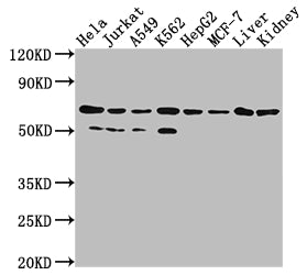 Western Blot | Positive WB detected in: Hela whole cell lysate, Jurkat whole cell lysate, A549 whole cell lysate, HepG2 whole cell lysate, MCF-7 whole cell lysate, Rat liver tissue, Rat kidney tissue | All lanes: AIFM1 antibody at 1:2000 | Secondary | Goat polyclonal to rabbit IgG at 1/50000 dilution | Predicted band size: 67, 36, 29, 27 kDa | Observed band size: 67 kDaAIFM1 Recombinant Monoclonal Antibody