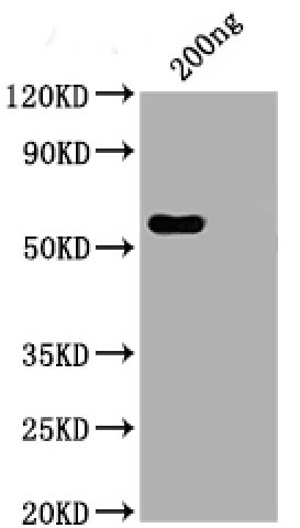 Western Blot Positive WB detected in: His tag-tagged SARS-CoV-2 nucleocapsid recombinant protein from E. Coli (the antibody SARS-CoV-2 nucleocapsid antibody at 1:1000 (the antibody Secondary Peroxidase-Affinipure Goat Anti-Human IgG Fc Fragment Specific at 1/20000 dilution Predicted band size: 48 kDa Observed band size: 55 kDaN Recombinant Monoclonal Antibody