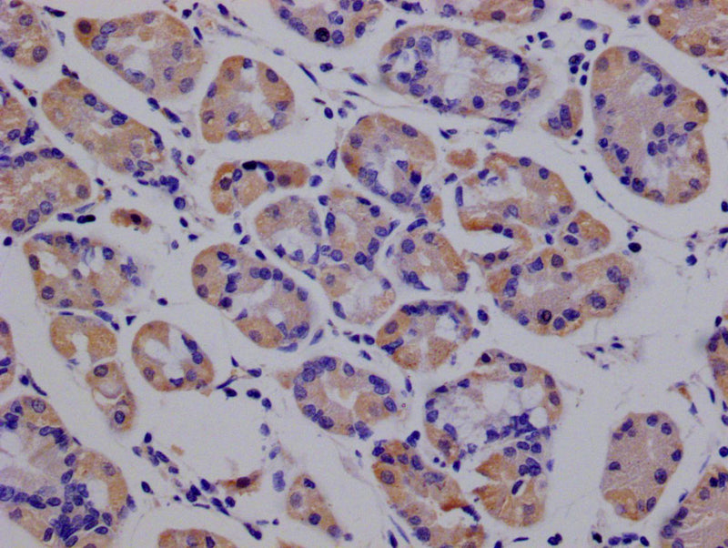 IHC image of PRDX3 Recombinant Monoclonal Antibody diluted at 1:100 and staining in paraffin-embedded human stomach tissue performed on a Leica BondTM system. After dewaxing and hydration, antigen retrieval was mediated by high pressure in a citrate buffer (pH 6.0). Section was blocked with 10% normal goat serum 30min at RT. Then primary antibody (1% BSA) was incubated at 4°C overnight. The primary is detected by a Goat anti-rabbit polymer IgG labeled by HRP and visualized using 0.05% DAB.PRDX3 Recombinant Monoclonal Antibody