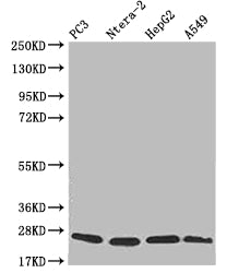 Western Blot | Positive WB detected in: PC3 whole cell lysate, Ntera-2 whole cell lysate, HepG2 whole cell lysate, A549 whole cell lysate | All lanes: PRDX3 antibody at 1:2000 | Secondary | Goat polyclonal to rabbit IgG at 1/50000 dilution | Predicted band size: 28, 26 kDa | Observed band size: 20-28 kDaPRDX3 Recombinant Monoclonal Antibody