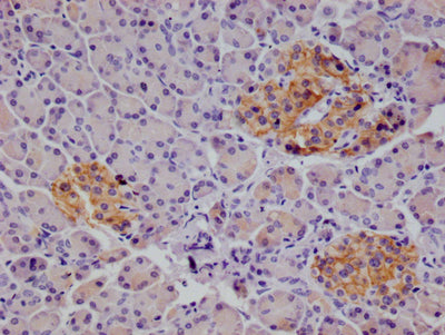 IHC image of ALCAM Recombinant Monoclonal Antibody diluted at 1:100 and staining in paraffin-embedded human pancreatic tissue performed on a Leica BondTM system. After dewaxing and hydration, antigen retrieval was mediated by high pressure in a citrate buffer (pH 6.0). Section was blocked with 10% normal goat serum 30min at RT. Then primary antibody (1% BSA) was incubated at 4°C overnight. The primary is detected by a Goat anti-rabbit polymer IgG labeled by HRP and visualized using 0.05% DAB.ALCAM Recombinant Monoclonal Antibody