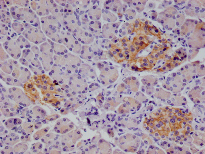 IHC image of ALCAM Recombinant Monoclonal Antibody diluted at 1:100 and staining in paraffin-embedded human pancreatic tissue performed on a Leica BondTM system. After dewaxing and hydration, antigen retrieval was mediated by high pressure in a citrate buffer (pH 6.0). Section was blocked with 10% normal goat serum 30min at RT. Then primary antibody (1% BSA) was incubated at 4°C overnight. The primary is detected by a Goat anti-rabbit polymer IgG labeled by HRP and visualized using 0.05% DAB.ALCAM Recombinant Monoclonal Antibody